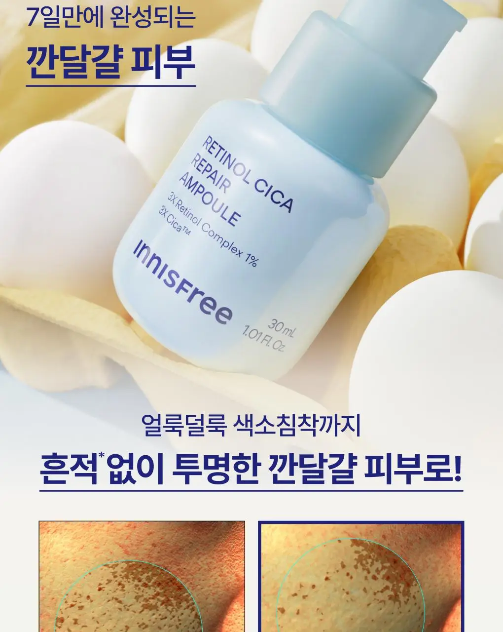 [1+1] 이니스프리 레티놀 시카 모공 흔적 앰플 30ml 리필기획(+30ml 리필) 상세페이지 26